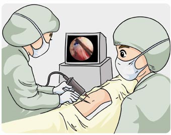 人體植入醫(yī)療器械封口潔凈要求 人體植入醫(yī)療器械封口潔凈要求